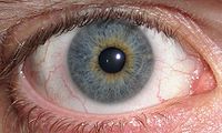 Central heterochromia.jpg